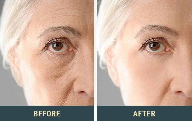 product that could turn back the clock on aging, erasing deep wrinkles, fine lines, dry skin, and dark spots in just one week