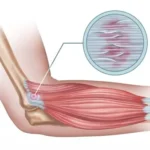 what can i do about muscle soreness 1