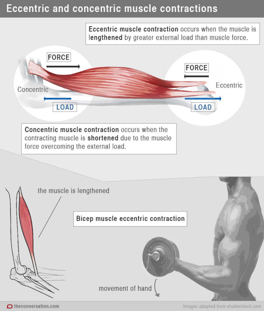What Can I Do About Muscle Soreness?